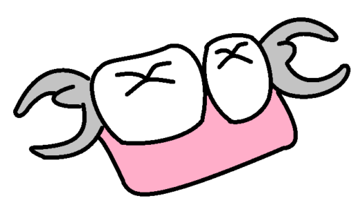入れ歯の耐久性